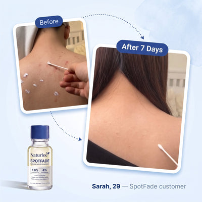 Naturlee - SPOTFADE lotion