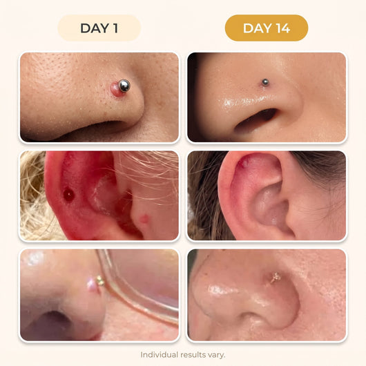 Naturlee - Piercing aftercare drops