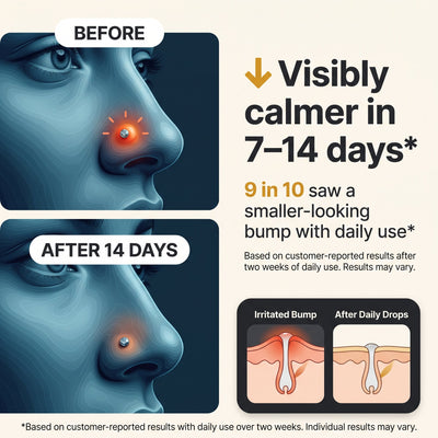 Naturlee - Piercing aftercare drops
